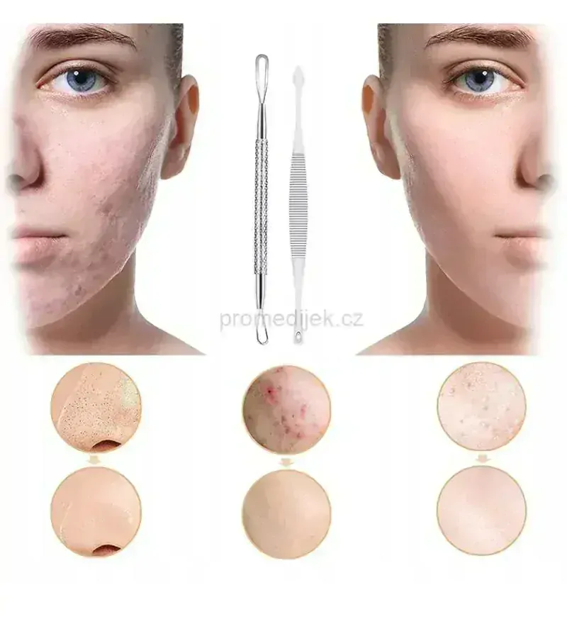 Sada expresorů pro hloubkové čištění pleti 7ks